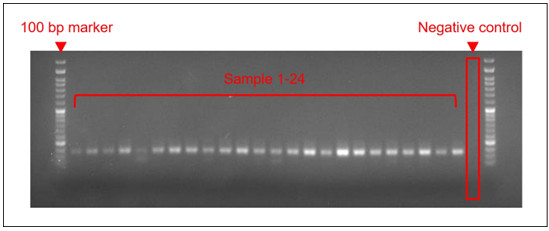 Figure 1. Preliminary establishment of a genomic DNA extraction protocol for rose. The extracted DNA was validated by housekeeping gene amplification and showed stable amplification performance, providing a foundation for subsequent molecular marker analyses.